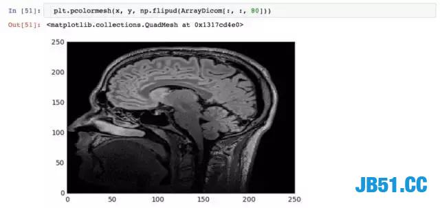 Python还能用于医学方面！这就亮瞎了我的钛合金人眼了！深度学习